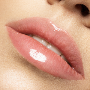 Aumento de volumen y/o perfilado labial con Ácido Hialurónico 1ml- Juvéderm