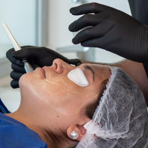 2 Peeling Químico Facial Me Line + Crema día y noche Me Line