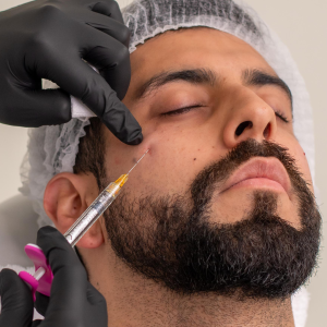 Armonización Ojeras Hundidas con Ácido Hialurónico 1ml - Juvéderm