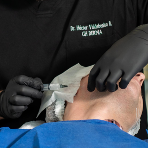 Sculptra 1 sesión 1 vial
