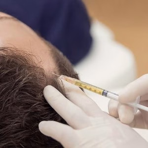 PRP + Dutasteride Capilar 6 sesiones